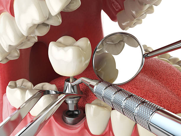 Best Emergency Dental Extractions in Tusculum, TN